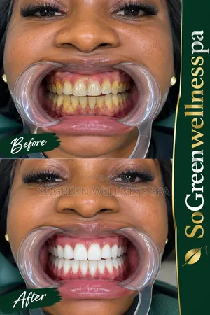 SoGreen Wellness Spa Promo - 50% Off