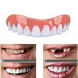 Instant Smile Teeth Cover - Veneer - 3