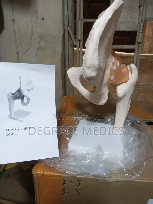 Life-Size Hip Joint Model - 1