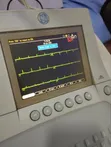 GE Mac 3500 ECG Machine (12 Channel) - 2