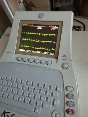 GE Mac 3500 ECG Machine (12 Channel)