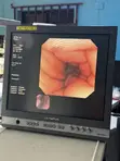 Olympus CV-260/CLV-260 Endoscopy System da Gastroscope & Colonoscope - 3