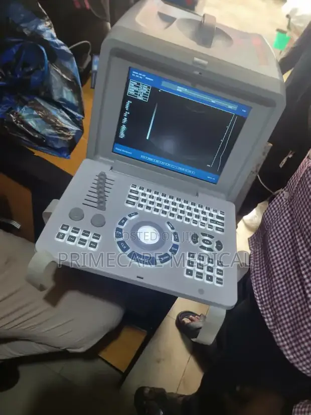 Tabletop Ultrasound Machine - 1