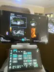 Mindray Consona N5 Injin Ultrasound - 3