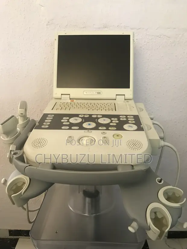 Siemens Acuson P300 Ultrasound Machine - 1