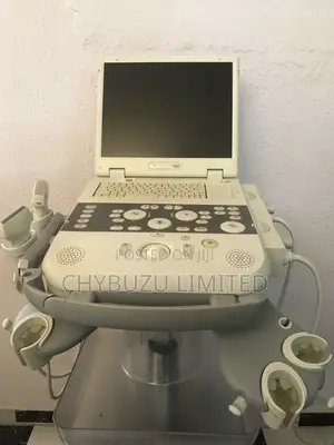 Siemens Acuson P300 Ultrasound Machine