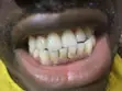Sabis na Zangon Haƙori da Fari - 1