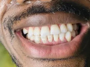 Sabis na Zangon Haƙori da Fari