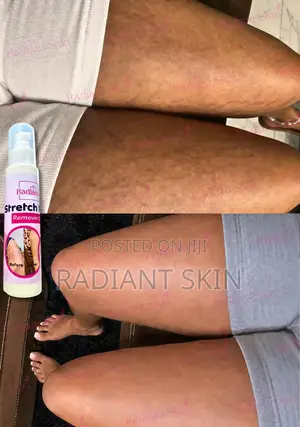 Radiant Cream Don Cire Alamar Tsayuwa - 100ml