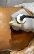 WLS Skin Med Spa: Teeth Whitening, Laser Hair Removal, Facials & Massage in Lekki - 3
