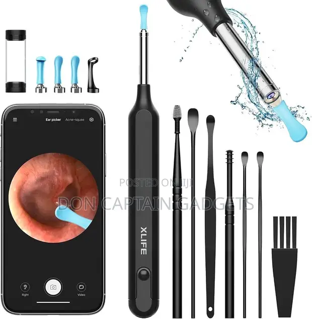 Visual Earwax Removal Kit with Camera & LED Light (7-in-1) - 1