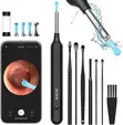Visual Earwax Removal Kit with Camera & LED Light (7-in-1) - 1