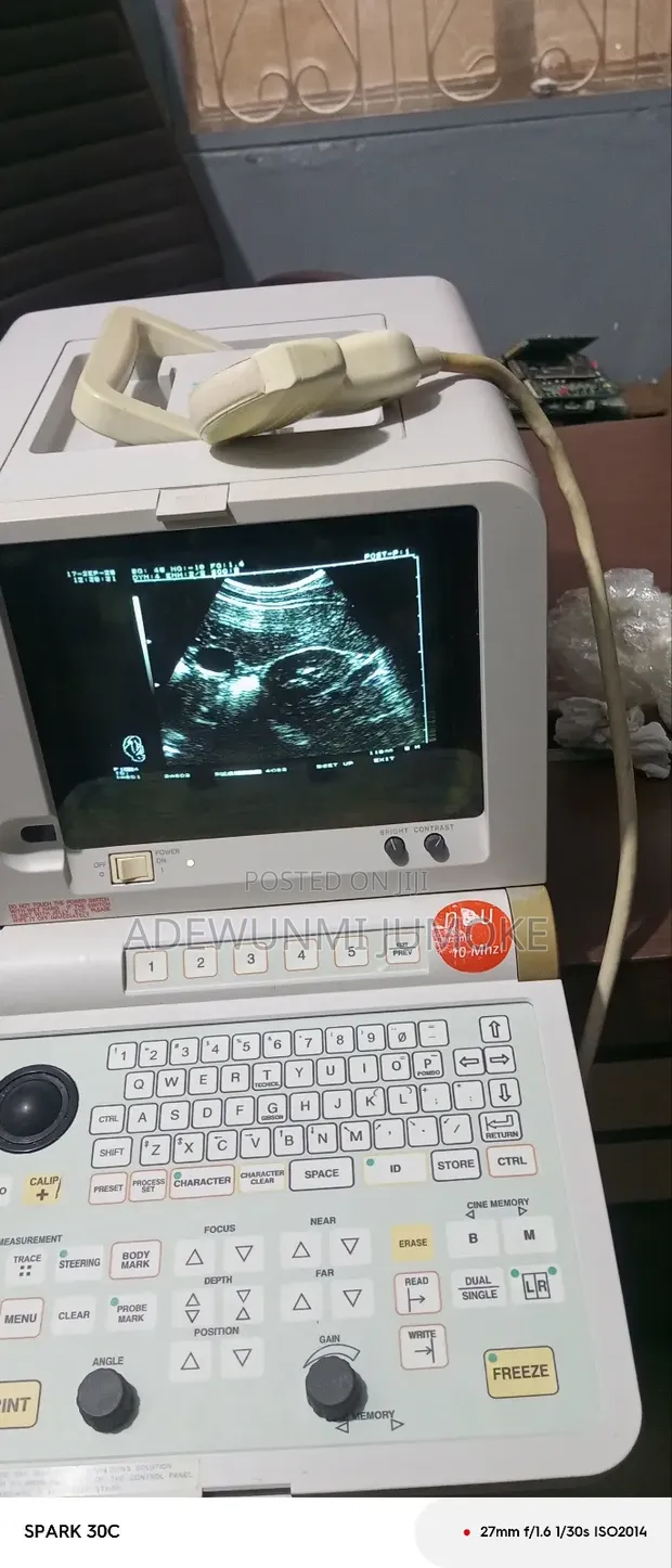 Hitachi Table Top Ultrasound with Convex Probe - 1