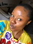 Facial Set for Hyperpigmentation & Dark Spots - 3