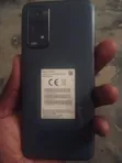 Xiaomi Redmi Note 11 128GB Baki - 3