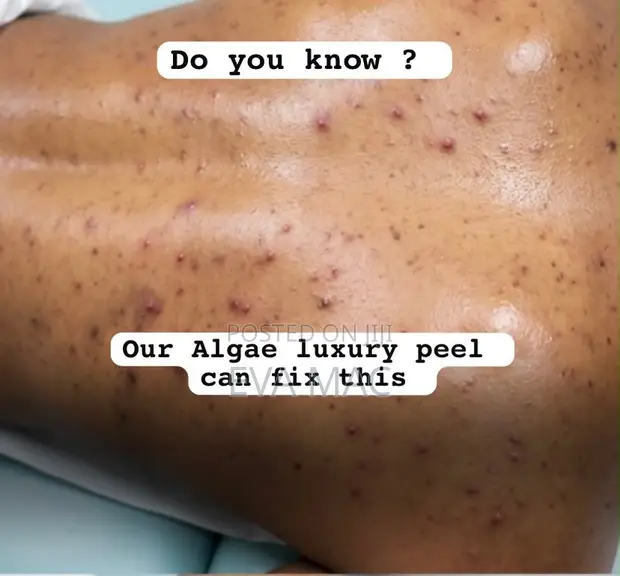 Evamac Organic Algae Herbal Peel - Kayan Kwaskale Na Kwararru - 1