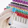 EDTA Blood Collection Tubes - Purple Top - 2