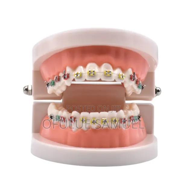 Teeth Fashion Braces - 1