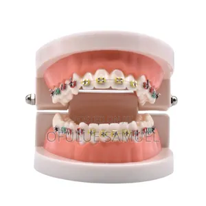 Teeth Fashion Braces