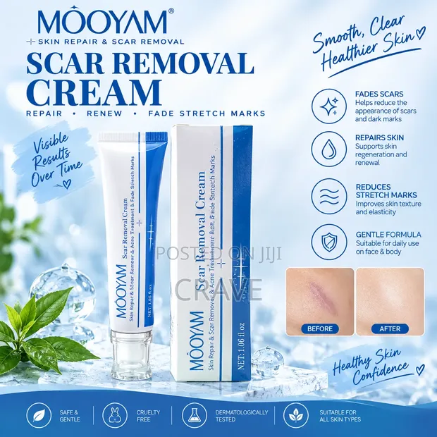 MOOYAM Scar Removal Cream - 30g - 1