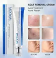 MOOYAM Scar Removal Cream - 30g - 2