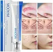MOOYAM Scar Removal Cream - 30g - 5