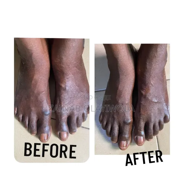 Mobile Pedicure & Home Service - Classic, Jelly & Paraffin Foot Care - 1