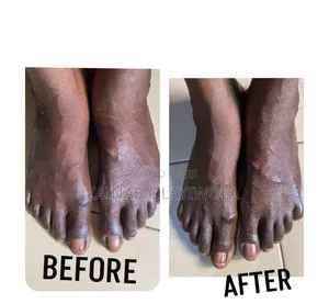 Mobile Pedicure & Home Service - Classic, Jelly & Paraffin Foot Care