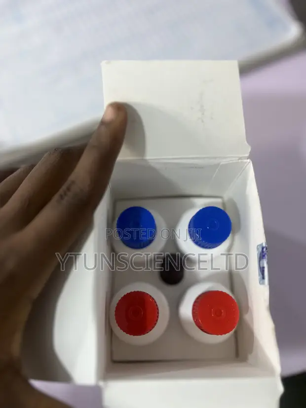 Agappe Diagnostic Reagents - 1