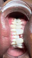 Shirley's Finesse: Fitar da Hakori, Braces, Tattoo da Sauran Sabis - 5