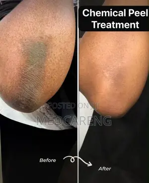MEDCARENG Facial Treatments in Ajah, Lagos