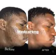 MEDCARENG Facial Treatments in Ajah, Lagos - 3