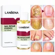 Lanbena Nail Repair Essence - 15ml - 3