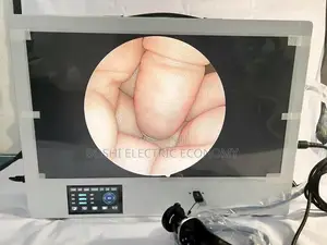 Portable Endoscope Laparoscope Video Medical System (4-in-1)