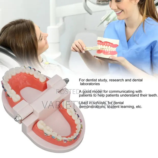 Dental Orthodontic Teeth Model with Colorful Braces - 1