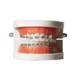 Dental Orthodontic Teeth Model with Colorful Braces - 3