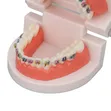 Dental Orthodontic Teeth Model with Colorful Braces - 4