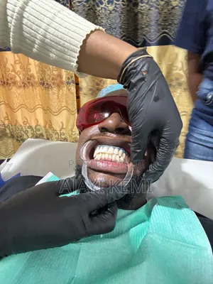 Kemal's Place: Professional Teeth Whitening in Ibadan