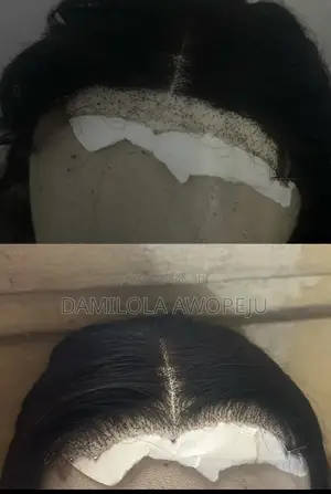 Wig Refilling and Ventilation Service