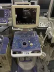 Injin Ultrasound - An Yi Amfani Da Shi - 1