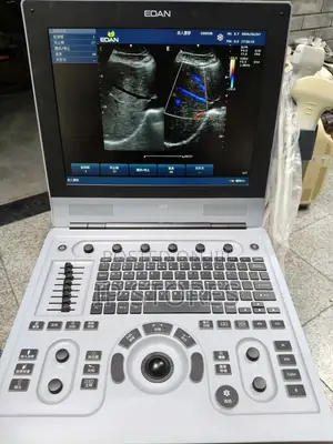 Portable Diagnostic Ultrasound System