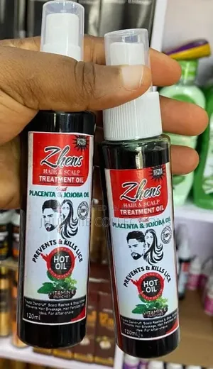 Zhens Hair Treatment for Lice, Itching, Dandruff